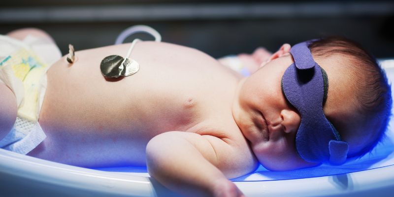 Terapia intensiva neonatale webcam rafforza il legame tra i bimbi e i genitori