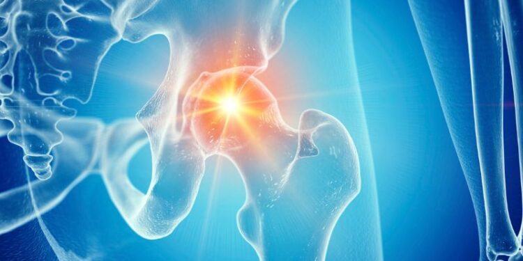 Rigenerare la cartilagine con gli ultrasuoni, nuova cura per l’artrosi