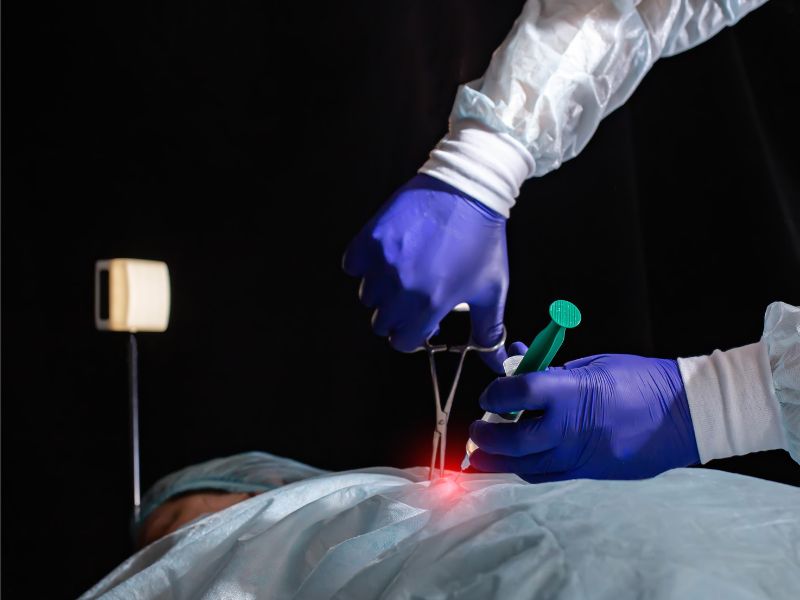 Tumori al colon retto, arriva la rivoluzionaria biopsia liquida