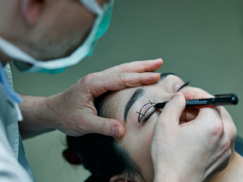 Addio palpebre cadenti con la medicina rigenerativa
