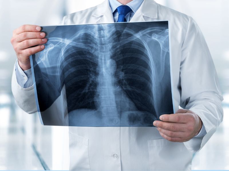 La Radiologia medica ‘potenziata’ dall’Intelligenza Artificiale