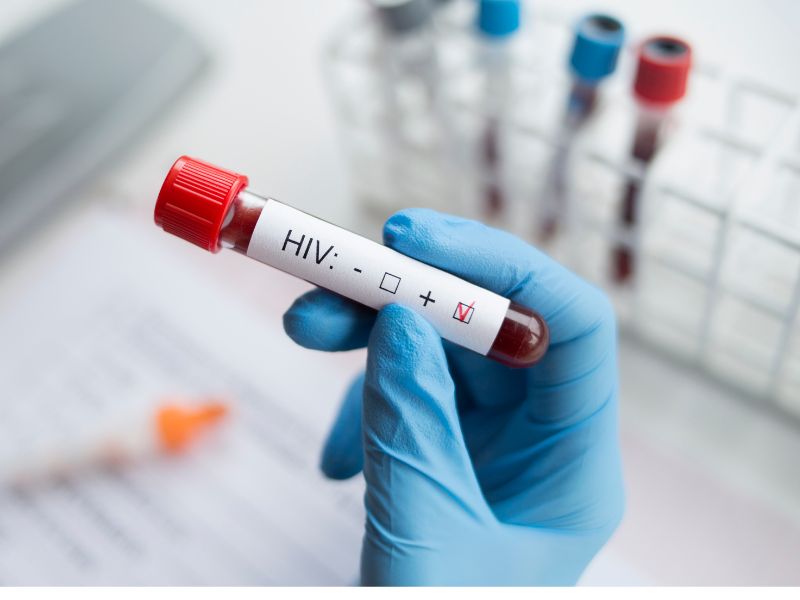 Hiv in Italia