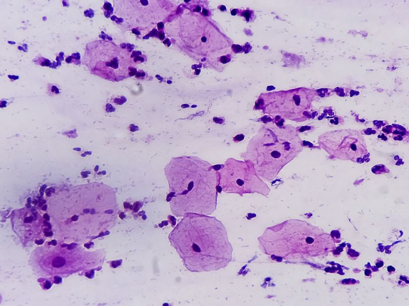 Papillomavirus: comprendere il rischio per prevenirlo