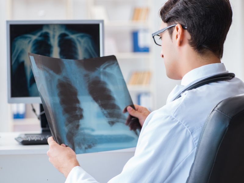 Scoperta ‘firma molecolare’ per curare il tumore al polmone