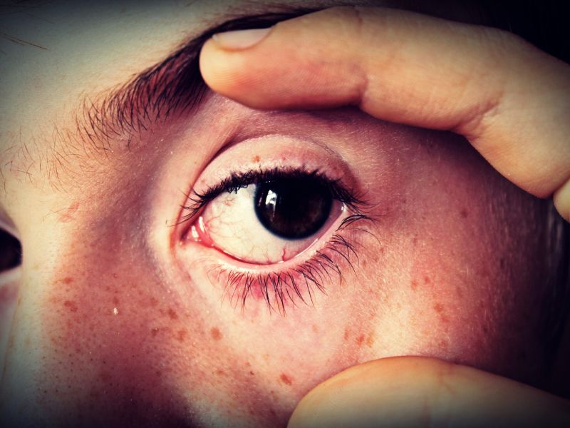 Diagnosi non invasive: occhi specchio della salute