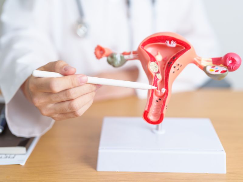 Endometriosi: dati e sfide di una malattia invalidante
