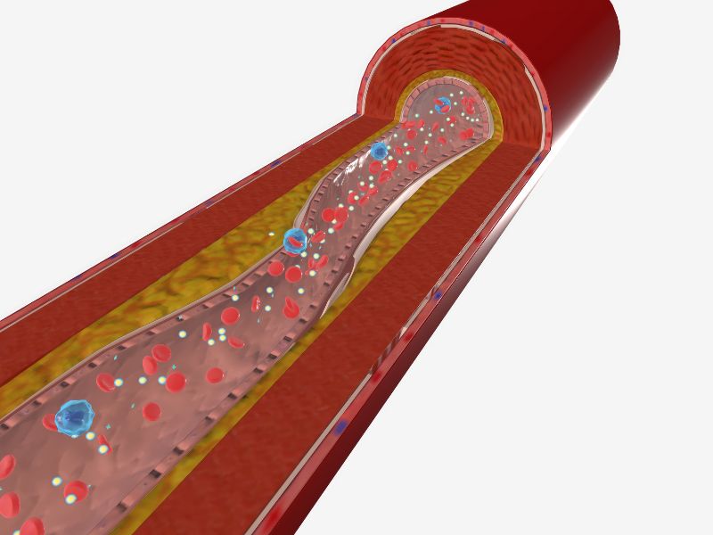 Farmaci a mRNA: nuove speranze per combattere il colesterolo